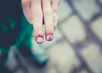 VDI: 2020. gadā darba vietās notikuši 17 letāli nelaimes gadījumi